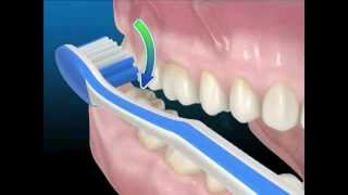 Tecniche di igiene orale Uso corretto dello spazzolino da denti [upl. by Jesher564]