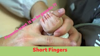 Brachydactyly  Baby Had Short Fingers Mother Wanted it to Be Genetic [upl. by Emalee]