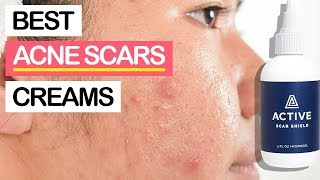 10 Best Creams To Fade Away Acne Scars 2019  Get Rid Of All Pimple Marks amp Dark Spots [upl. by Quillon]