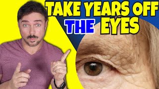 Take 20 Years Off Your Eye Area  Chris Gibson [upl. by Nielsen]