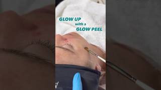 Glow up with a glow peel  treat yourself this fall at Studio Kiku chemicalpeel vancouverbc [upl. by Egide]