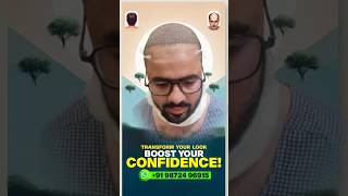 Best Hair Transplant clinic  How to stop Hairfall hair hairtransplant newvideo youtubeshorts [upl. by Kamaria]