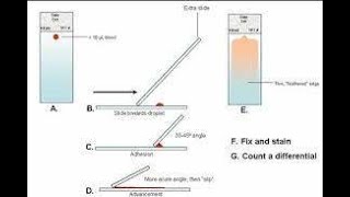 مسحة الدم Blood film و الأخطاء الشائعة في تحضيرها Blood film preparation method [upl. by Geller]