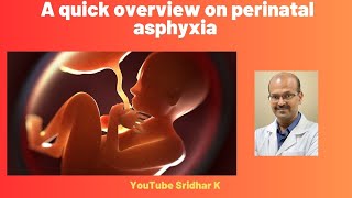 Perinatal asphyxia A quick overview asphyxia perinatalasphyxia birthasphyxia [upl. by Htez]