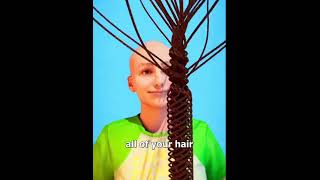 Bald edit foryou edit recomened [upl. by Asile]