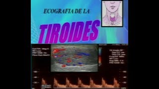 ECOGRAFIA DOPPLER DE TIROIDES [upl. by Nolrev]