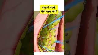 नाक में गंदगी कैसे साफ करें healthysarvada shortsfeed healthylifestyle healthyliving amazing [upl. by Modeerf909]