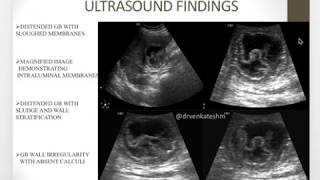 Gangrenous cholecystitis  A rare Entity [upl. by Inittirb]