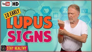 10 Lupus Disease Symptoms and Causes [upl. by Gaskill]