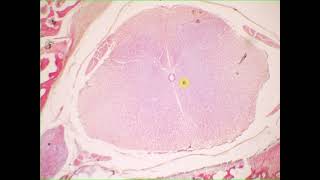 Interneuron sensory neuron pseudounipolar neuron ependymal cells satellite cells Spinal cord amp g [upl. by Zondra]