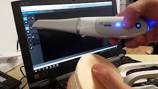 ACER Predator Helios 300 and Carestream Dental IOS CS3600 in action [upl. by Appilihp]