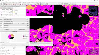 Pixel classification with QuPath epithelium and stroma segmentation in fluorescence images [upl. by Aerona926]