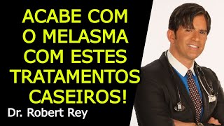 ACABE COM O MELASMA COM ESTES TRATAMENTOS CASEIROS  Dr Rey [upl. by Alyac]