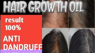 hair growth oil hair growth rosemary oil for hair growth hair growth tips wild growth hair oil [upl. by Anesuza]