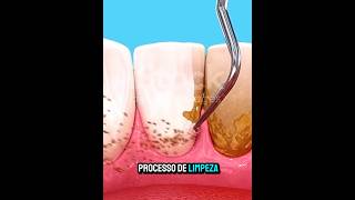 Essa pode ser sua melhor escolha para limpar os Dentes🤔 [upl. by Racklin]