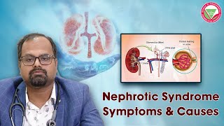 Nephrotic Syndrome occurs when the kidneys leak too much protein into the urine [upl. by Gabel]