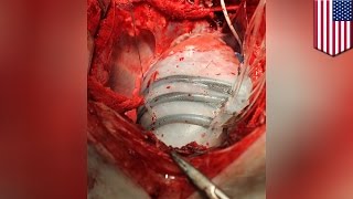 Robot heart Soft robotic sleeve helps simulate heart beating to push blood through  TomoNews [upl. by Tammara]