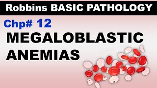 Ch12  Megaloblastic Anemias  Pernicious Anemia  Blood Pathology  Dr Asif Lectures [upl. by Eugene]