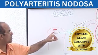 Polyarteritis Nodosa Clinical Features  Complications  Management [upl. by Genevieve]