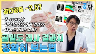 우문공답 나의 뼈는 건강할까 골밀도 검사 결과지 정확히 보는법 [upl. by Hardwick]