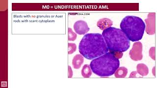 Hematology  2  U2L22  FAB classification of AML subtypes  1 [upl. by Stouffer]