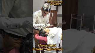 Chemical peels for skin lightning acne melasma pigmentation chemicalpeel skincare panipat [upl. by Hoyt]