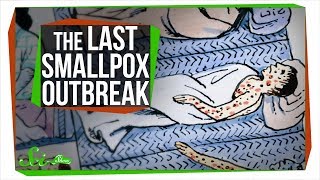 The Last Major Smallpox Outbreak in America [upl. by Ferris997]