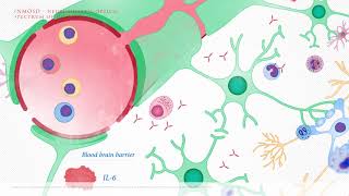 06  NMOSD neuromielitis optica spectrum of disorders [upl. by Armin673]