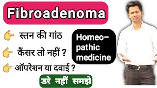 How to treat fibroadenoma with homeopathy  homeopathic medicine  Cancer of breast [upl. by Arlee]