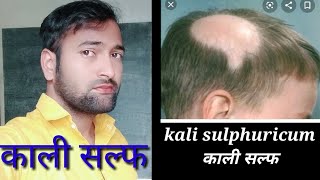 kali sulph।kali sulph 6x uses ।kali sulphuricum 12x uses। Kali sulphuricum ।Kali sulph। Vikas dhp [upl. by Chon322]