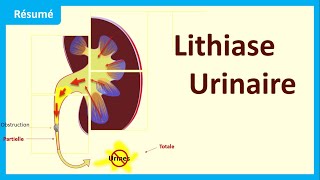 Lithiase urinaire 💧  questce que cest  🧐  Résumé  UroNephrologie [upl. by Weikert]