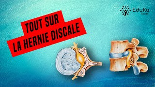 HERNIE DISCALE LOMBAIRE  TOUT SAVOIR SUR LES TRAITEMENTS EXERCICES CONSEILS [upl. by Sille]