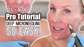 Deep Microneedling on Face  Neck  Chest 💕 PRO TUTORIAL microneedling antiagingskincare [upl. by Nallid]