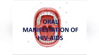 Oral manifestation of HIVAIDS [upl. by Oicanata]