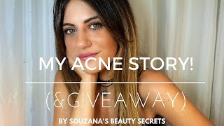 My acne story amp GIVEAWAY  Souzanas Beauty Secrets [upl. by Ling726]