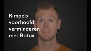 Rimpels voorhoofd voorhoofdrimpels verwijderen met Botox [upl. by Admana378]