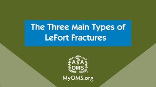 The Three Main Types of LeFort Fractures [upl. by Anthe]