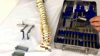 D motion cervical disc prosthesis [upl. by Nirol301]