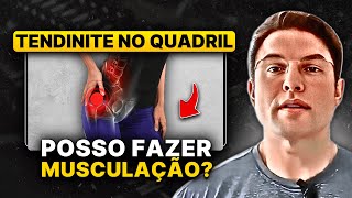 Tendinite No Quadril x Musculação  Muzy Explica [upl. by Katzen]