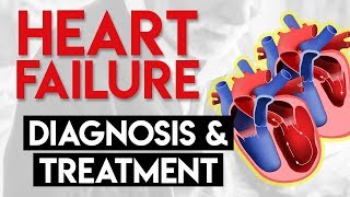 Diagnosis and Treatment  Heart Failure Part 4 [upl. by Imak589]