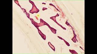 Intramembranous ossification cancellous spongy bone flatbone skull [upl. by Licec]