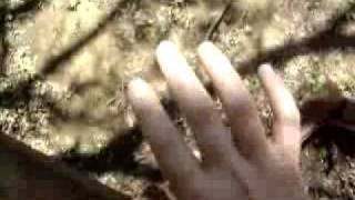 YouTube clonus hand tremor [upl. by Mary827]