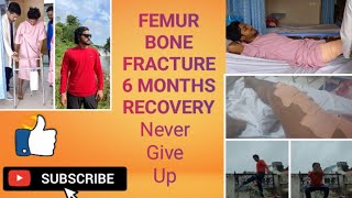 FEMUR FRACTURE RECOVERY 6 MONTHS femurfracture femurbone femur thighs nevergiveup staystrong [upl. by Tingey]