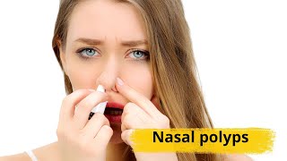 Nasal polyps Causes symptoms and treatments [upl. by Quenna725]