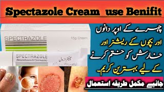 Spectazole cream uses in urdu  Clotrimazole and betamethasone [upl. by Trauts]