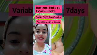 Herbal Anti Pimple Gel  Remove AcnePimples in 7days result 😱shortsfeed shorts shortsvideo acne [upl. by Amekahs]