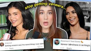 VENEERS ARE RUINING YOUR LIFE scientifically proven [upl. by Inihor]