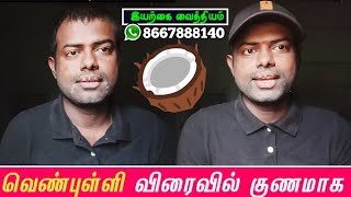 natural vitiligo makeup powder home remedies in tamil 16 May 2023 [upl. by Nosnevets]