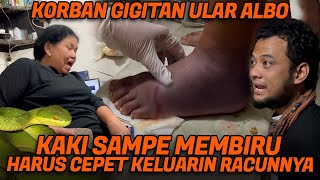 DIGIGIT ULAR VIPER POHON KAKI IBU INI BENGKAK MEMBIRU TERIAK KESAKITAN SAAT KAMI TOLONG [upl. by Esemaj916]