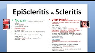 Ophthalmology 150 EpiScleritis Scleritis Difference periodica phenylephrine blanching scleromalacia [upl. by Edik]